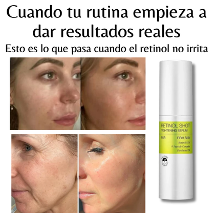 Renueva tu piel sin miedo al retinol